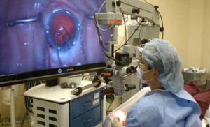 एम्स में 3 डी तकनीक से आंखों की सर्जरी शुरू